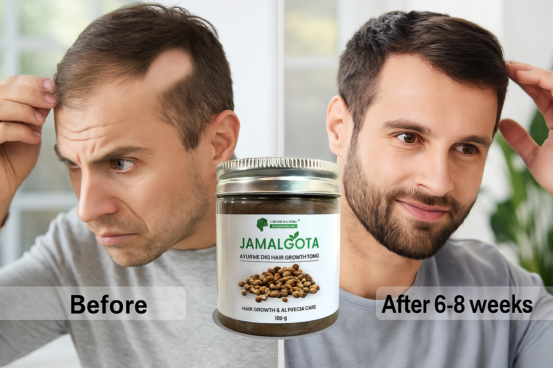 Jamalgota Hair Oil for Alopecia Treatment & Hair Growth – Asli Ayurvedic Power for Bald Patches