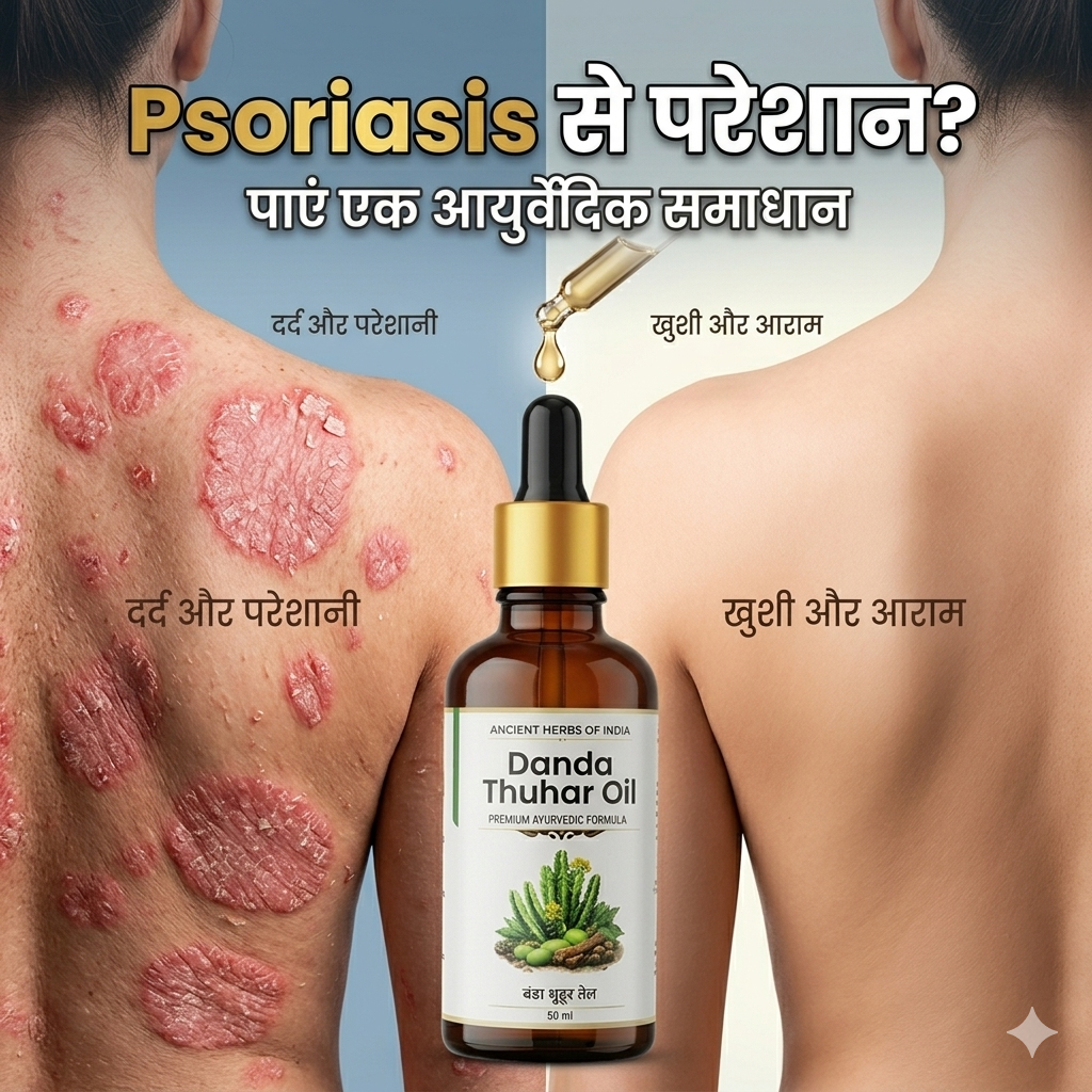 Danda Thuhar Oil for Psoriasis and Eczema Treatment Itching, dry skin
