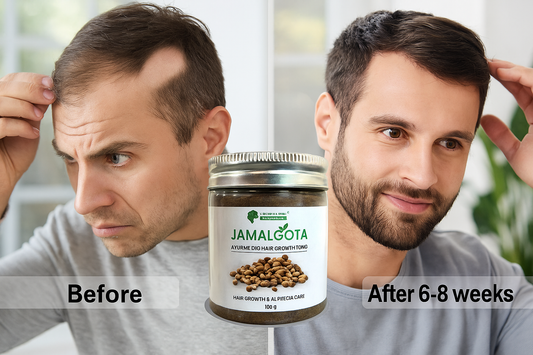 Jamalgota Hair Oil for Alopecia Treatment & Hair Growth – Asli Ayurvedic Power for Bald Patches