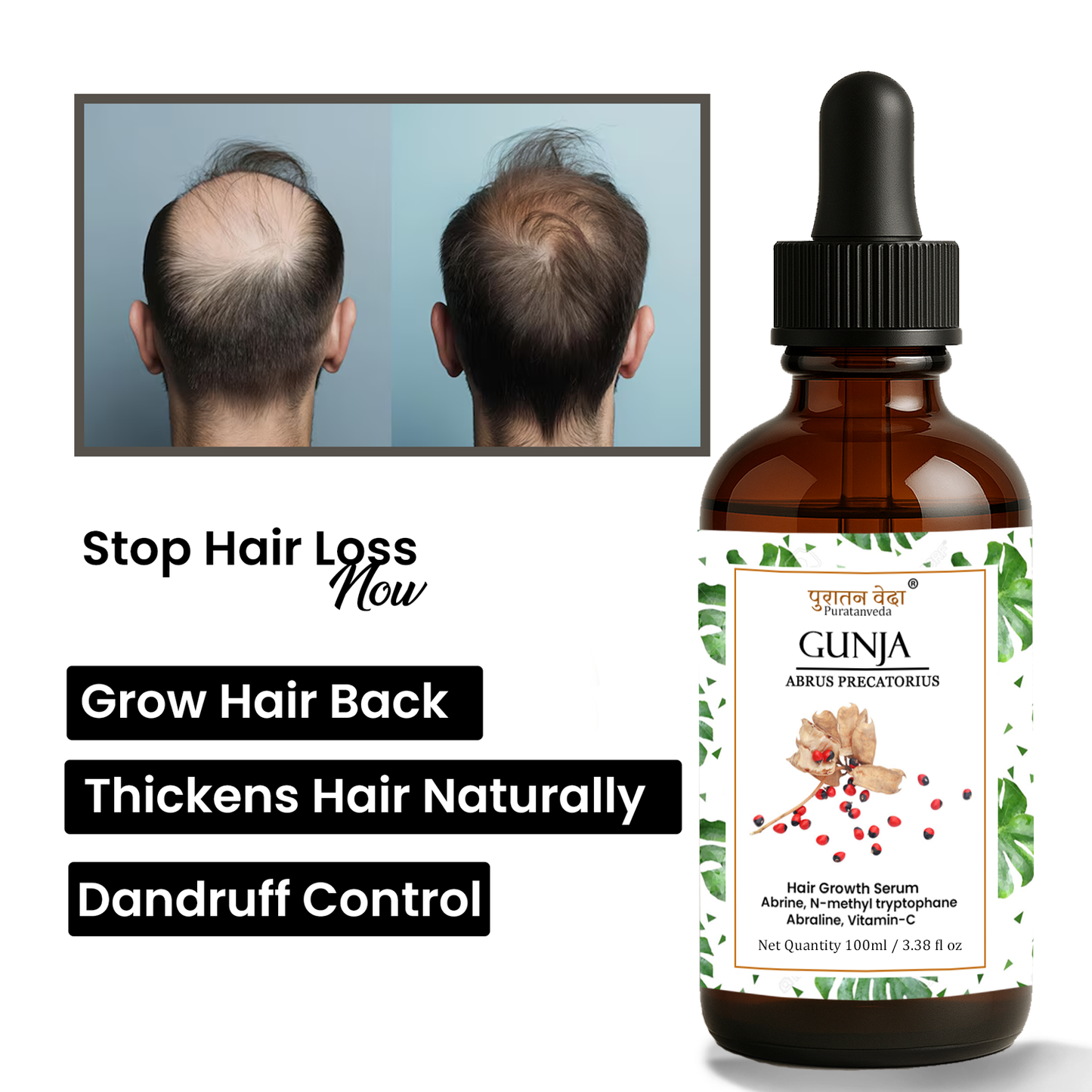 Gunja Ratti Hair oil for Alopecia Treatment and Hair Growth