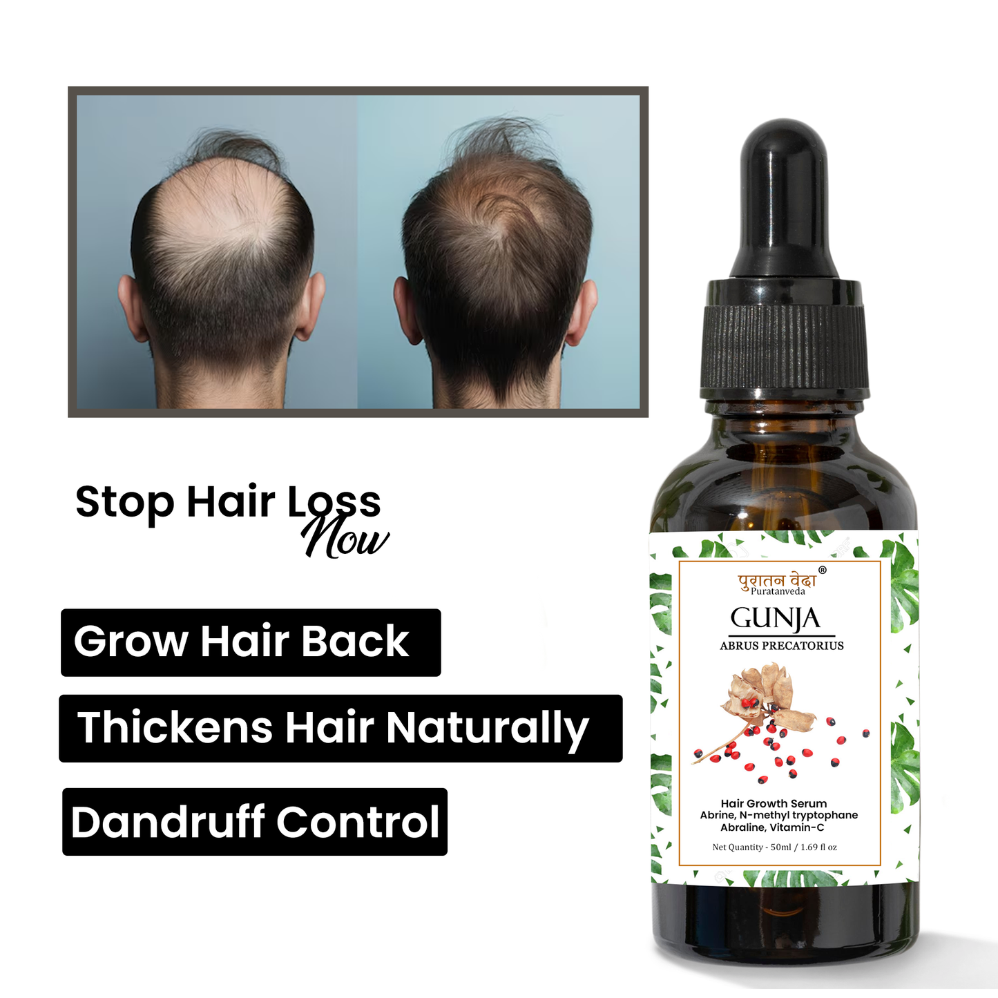 Gunja ratti Hair oil for Alopecia Treatment